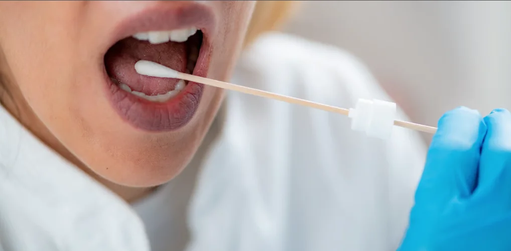 Tükürük Örneği ile Genetik Test: Süreç ve Yurtdışı Gönderim Detayları